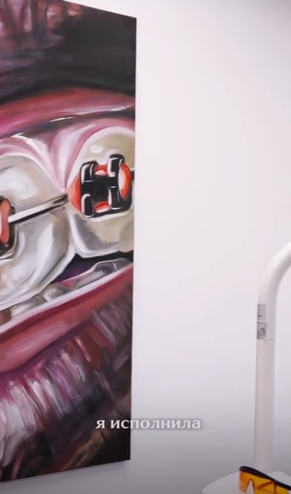 Брекеты для детей